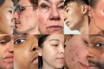Various skin issues