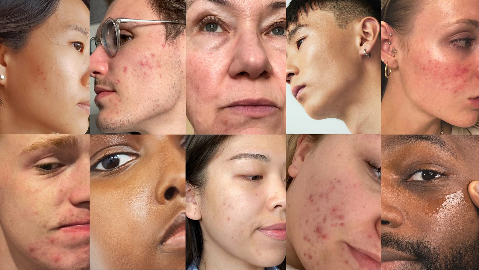 Various skin issues