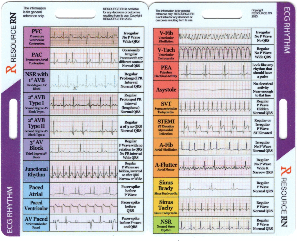  EKG Rhythm Interpretation Reference Card
